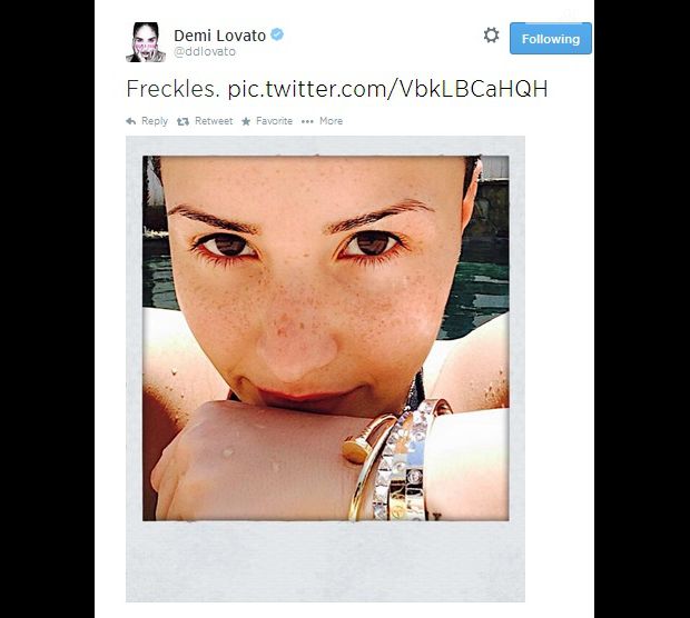 Cuida da pele também é importante para Demi Lovato! Ela mostrou as sardas no Twitter!