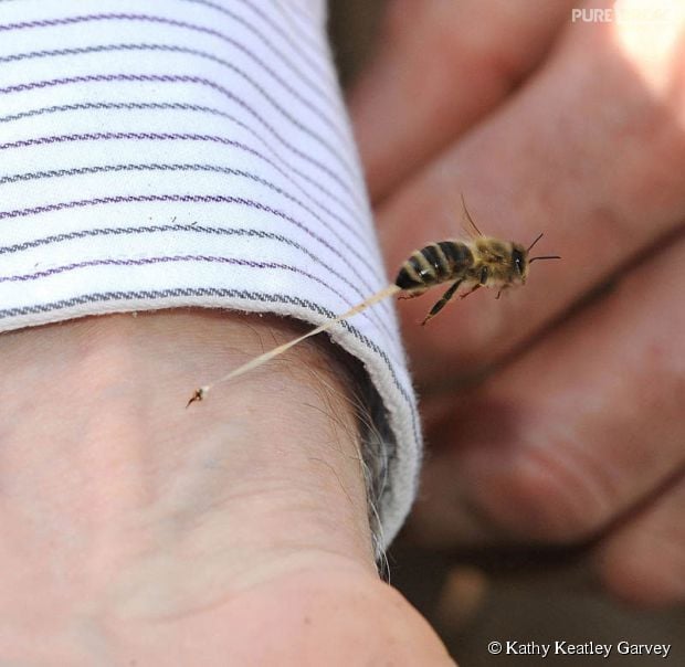 Momento exato de abelha picando o braço de uma pessoa