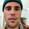 "Como você pode ver, este olho não está piscando. Eu não consigo sorrir deste lado do meu rosto...", contou  Justin Bieber