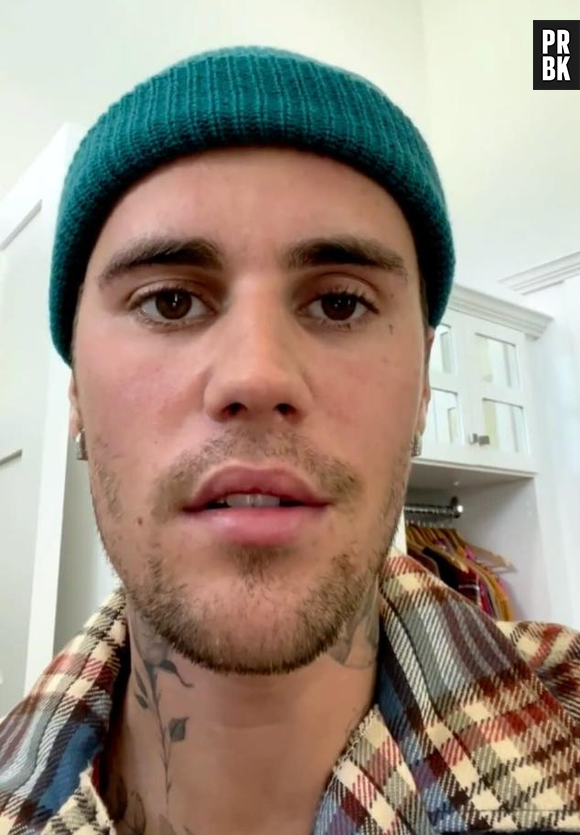 "Como você pode ver, este olho não está piscando. Eu não consigo sorrir deste lado do meu rosto...", contou  Justin Bieber