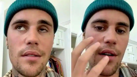 Justin Bieber e a Síndrome de RAM: entenda a condição que paralisou rosto do cantor