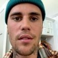 Justin Bieber revela dignóstico da Síndrome de Ramsay Hunt, que paralisou completamente o lado direito de seu rosto.