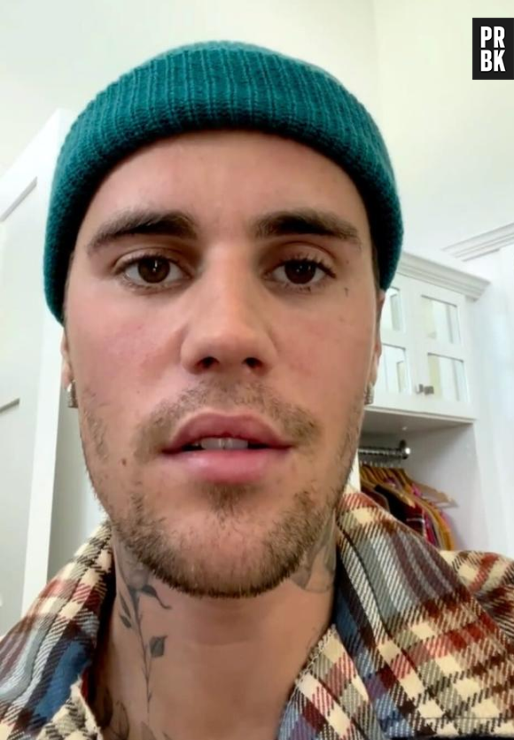 Justin Bieber revela dignóstico da Síndrome de Ramsay Hunt, que paralisou completamente o lado direito de seu rosto.