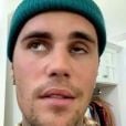 Justin Bieber mostrou rosto paralisado aos fãs no Instagram por conta da doença