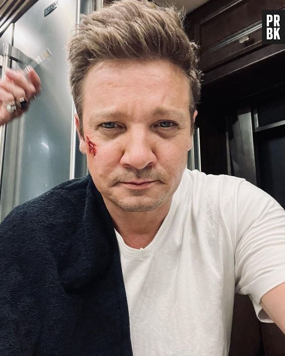 Jeremy Renner foi atingido por máquina de arar neve, no último domingo (1º), e perdeu muito sangue