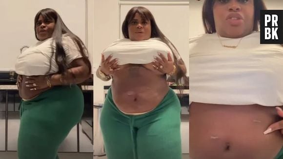 Jojo Todynho mostra resultado de bariátrica após perder 10kg