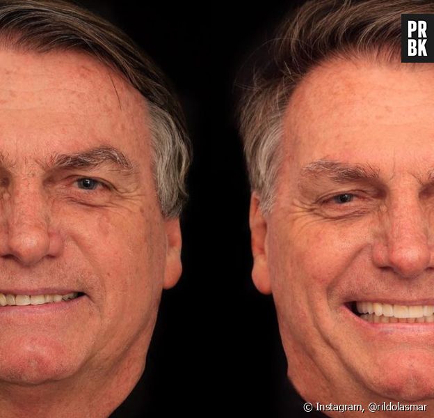 Antes e depois de Bolsonaro após harmonização facial