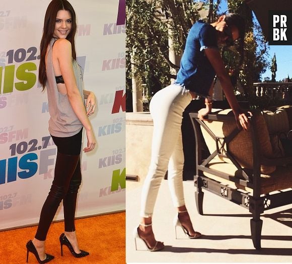 Kendall Jenner antes e depois