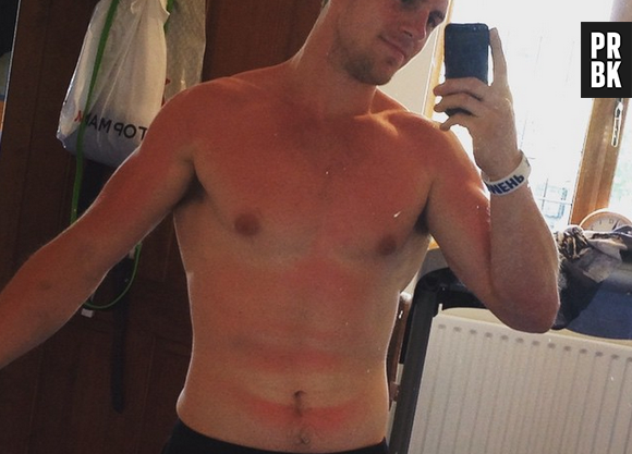 Por mais discretas que as marcas de sol sejam, sempre dá pra perceber