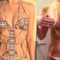 Confira as 16 piores queimaduras de sol que alguém poderia ter!