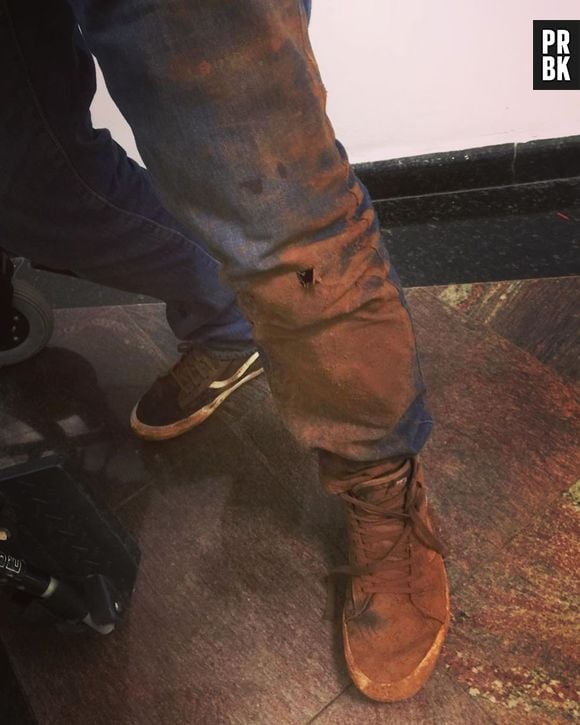 Após sofrer acidente, Henrique Fogaça, jurado do "MasterChef", posta fotos no Instagram