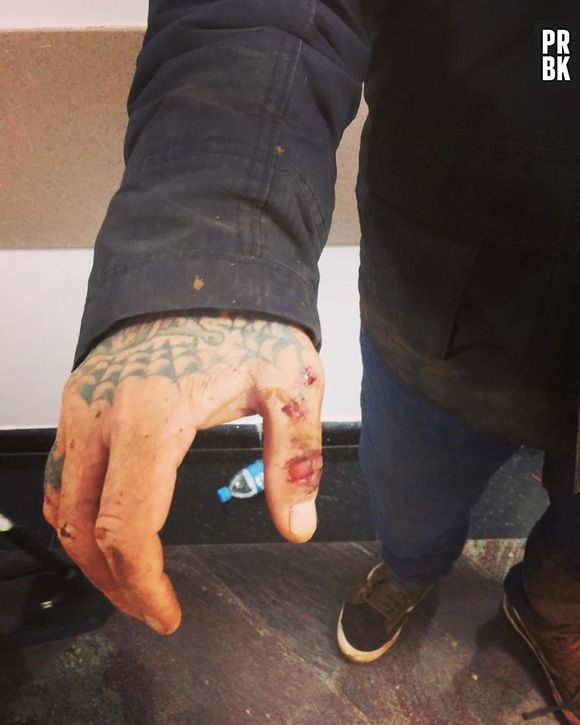 Do "MasterChef", Henrique Fogaça fratura costelas e machuca mão e joelho em acidente de moto