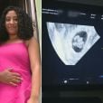 Jovem de 18 anos descobre que está grávida de quíntuplos