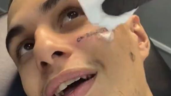 Fã tatua "c* da Anitta" no rosto em homenagem à cantora. Veja resultado