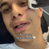 Fã tatua rosto com frase em homenagem à Anitta