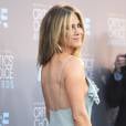 Jennifer Aniston também aderiu à rinoplastia