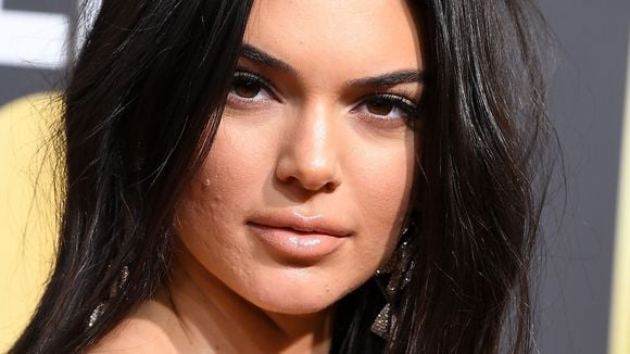 Os comentários maldosos sobre as espinhas deixaram Kendall Jenner realmente mal