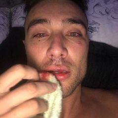 O youtuber Guigo Kieras apanhou da polícia militar de São Paulo e tudo indica que foi homofobia