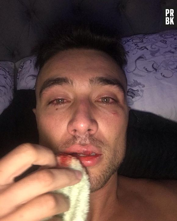 O youtuber Guigo Kieras foi agredido pela PM de São Paulo e tundo indica que foi um caso de homofobia