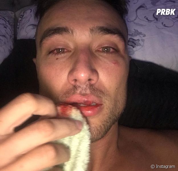 O youtuber Guigo Kieras foi agredido pela PM de São Paulo e tundo indica que foi um caso de homofobia