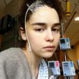 Emilia Clarke, de "Game of Thrones", publicou fotos do período que passou internada por causa de dois aneurismas