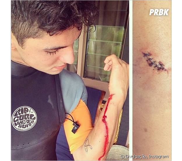 Gabriel Medina corta braço durante treino
