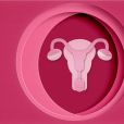 Endometriose: entenda a doença diagnosticada em Anitta