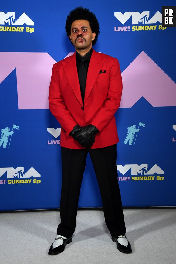 The Weeknd com rosto "machucado" no VMA de 2020