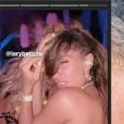 Fãs notaram espinhas no rosto de Anitta em show e cantora desabafou: "Uó"