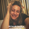 Lili Reinhart exibe rosto com produtos durante tratamento contra acnes