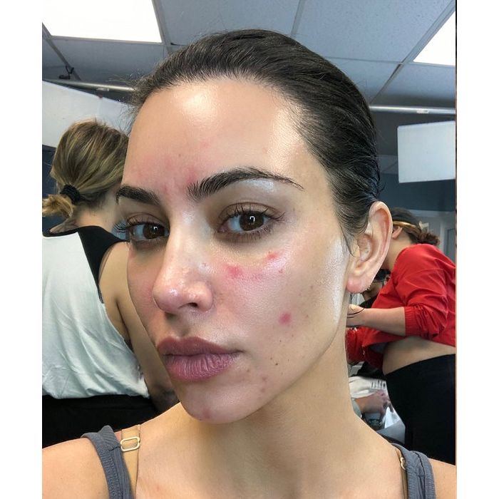 Kim Kardashian exibe foto sem filtro e sem maquiagem e rosto com espinha chama atenção