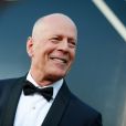 Bruce Willis: A variante comportamental dela causa perda de nervos nas áreas do cérebro que controlam a empatia, o julgamento e a conduta