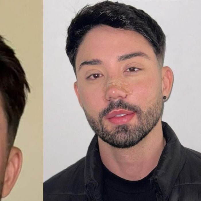 Antes e depois de Rico Melquiades: influenciador revela novo rosto