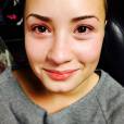  Demi Lovato -&nbsp;mesmo com o rosto inchado e sem maquiagem - continua linda 