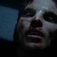 Scott (Tyler Posey) quase morreu em "Teen Wolf"