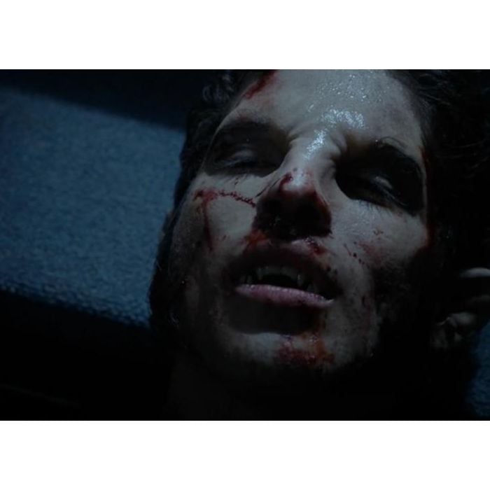 Scott (Tyler Posey) quase morreu em &quot;Teen Wolf&quot;