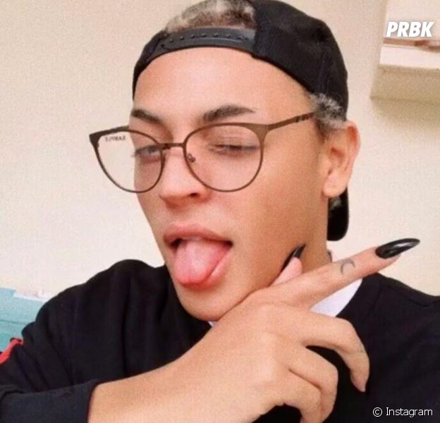 Veja o resultado da plástica que Pabllo Vittar fez no nariz!