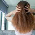 Confira 5 formas de recuperar seu cabelo ressecado