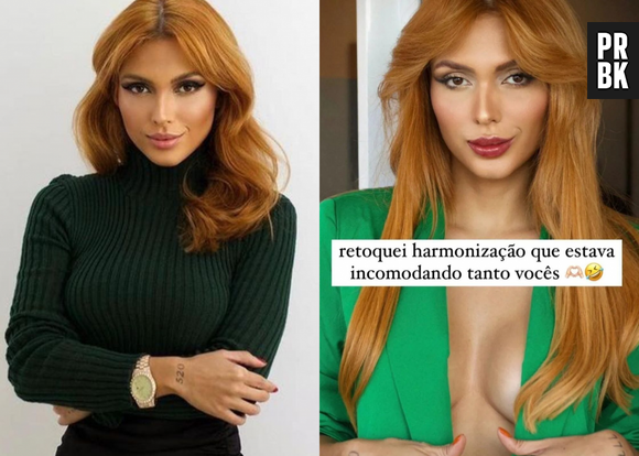 Antes e depois de Fernanda Campos