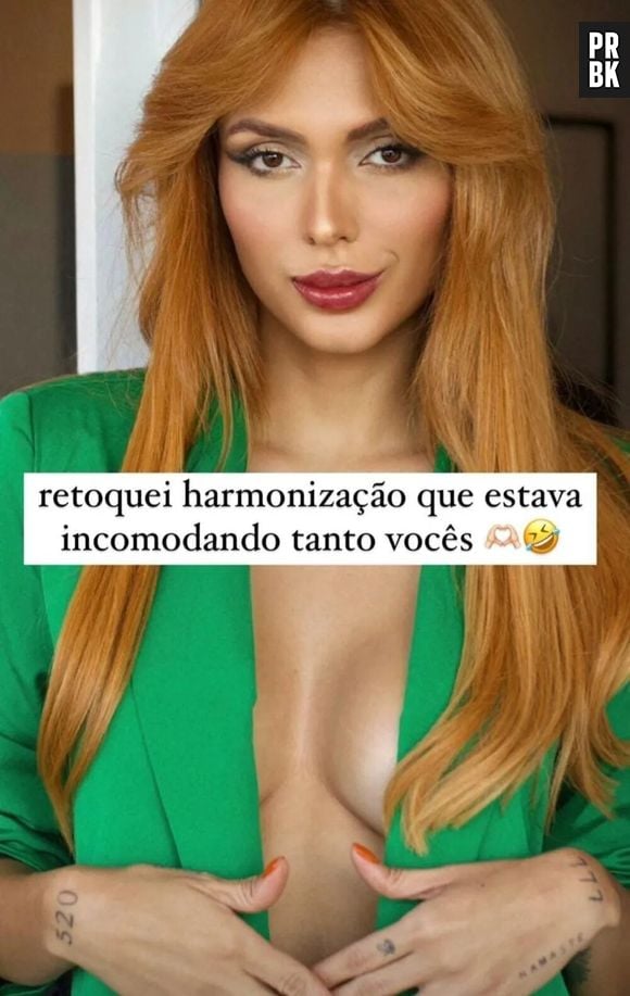 Fernanda Campos mostrou resultado após retocar harmoniação facial