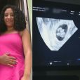 Jovem de 18 anos descobre aborto de quíntuplos