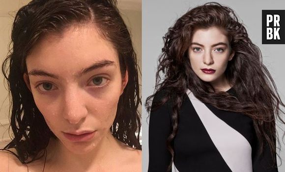 A cantora Lorde é outra que sempre assume o rosto sem maquiagem