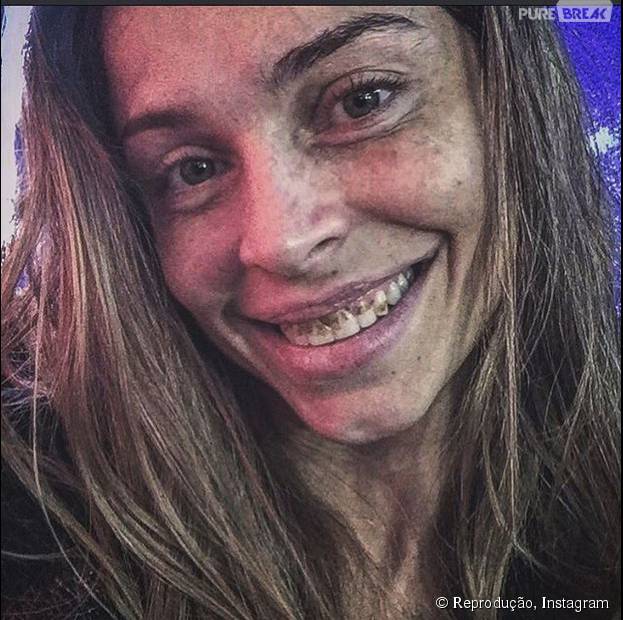 Grazi Massafera, de "Verdades Secretas", posta foto caracterizada como Larissa e com os dentes podres!