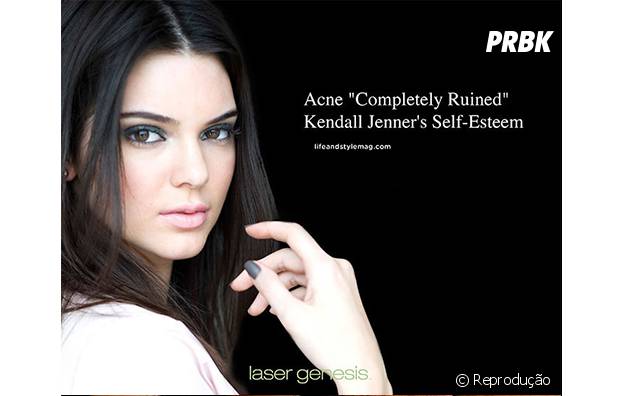 Empresa usa imagem de Kendall Jenner para vender produto para acne