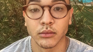Japa ironiza rumores sobre plásticas no rosto em vídeos no Snapchat e não confirma especulação!