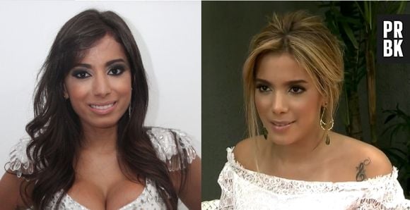 Anitta antes e depois das cirurgias plásticas