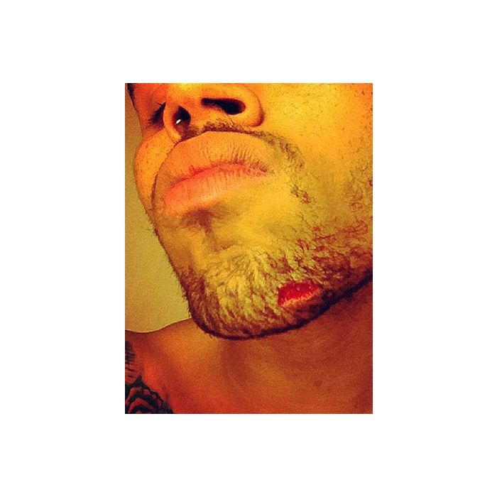 Depois da briga com Drake, que destruiu uma boate em Nova York, Chris Brown compartilhou uma foto dos ferimentos do combate