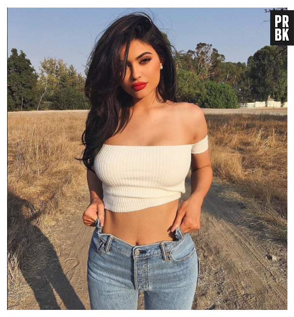 Kylie Jenner usou preenchimentos labiais durante anos