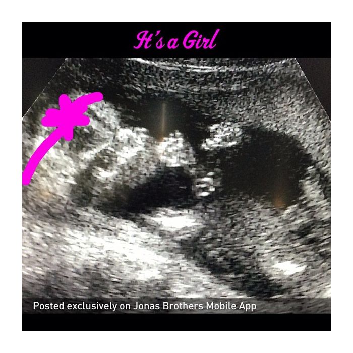 Kevin Jonas anunciou pelo Instagram o sexo do bebê que espera com a mulher Danielle: &quot;É uma menina! Obrigado a todos! Ela está chupando o dedo!&quot;