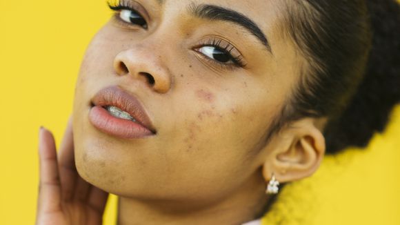 Skin care de dentro para fora: 5 ingredientes para inserir na dieta e ter uma pele bonita